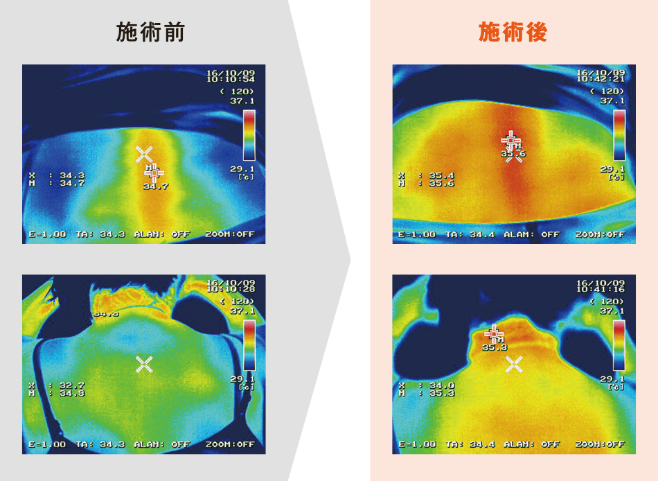 肩・腰の施術に対するビフォーアフター